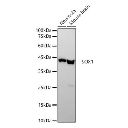 Western Blot - Anti-SOX1 Antibody [ARC2100] (A308012) - Antibodies.com