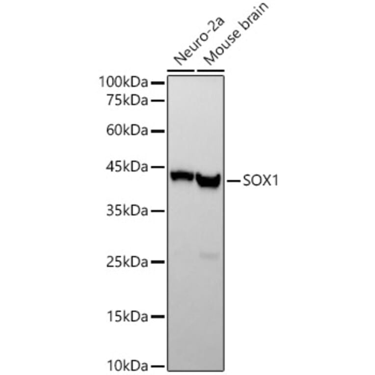 Western Blot - Anti-SOX1 Antibody [ARC2100] (A308012) - Antibodies.com