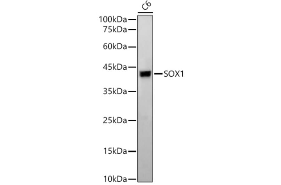 Western Blot - Anti-SOX1 Antibody [ARC2100] (A308012) - Antibodies.com