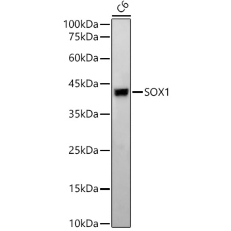 Western Blot - Anti-SOX1 Antibody [ARC2100] (A308012) - Antibodies.com