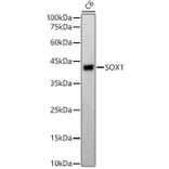 Western Blot - Anti-SOX1 Antibody [ARC2100] (A308012) - Antibodies.com