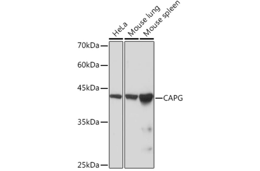 Western Blot - Anti-Actin Regulatory Protein CAPG/MCP Antibody [ARC2138] (A308013) - Antibodies.com