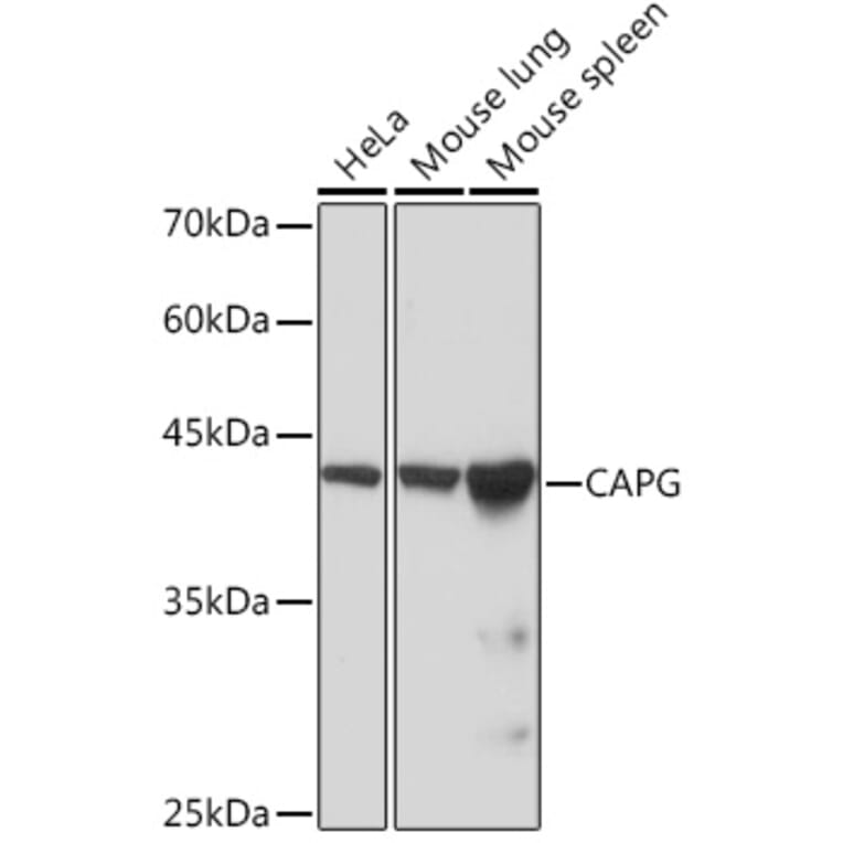 Western Blot - Anti-Actin Regulatory Protein CAPG/MCP Antibody [ARC2138] (A308013) - Antibodies.com