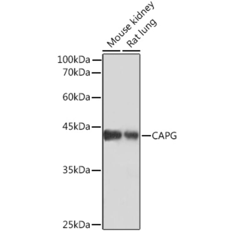 Western Blot - Anti-Actin Regulatory Protein CAPG/MCP Antibody [ARC2138] (A308013) - Antibodies.com