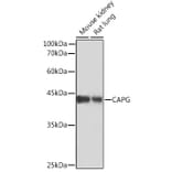 Western Blot - Anti-Actin Regulatory Protein CAPG/MCP Antibody [ARC2138] (A308013) - Antibodies.com