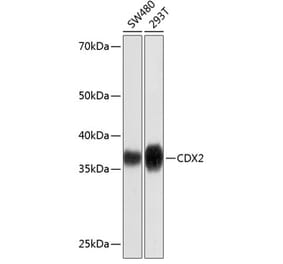 Western Blot - Anti-CDX2 Antibody [ARC0450] (A308015) - Antibodies.com