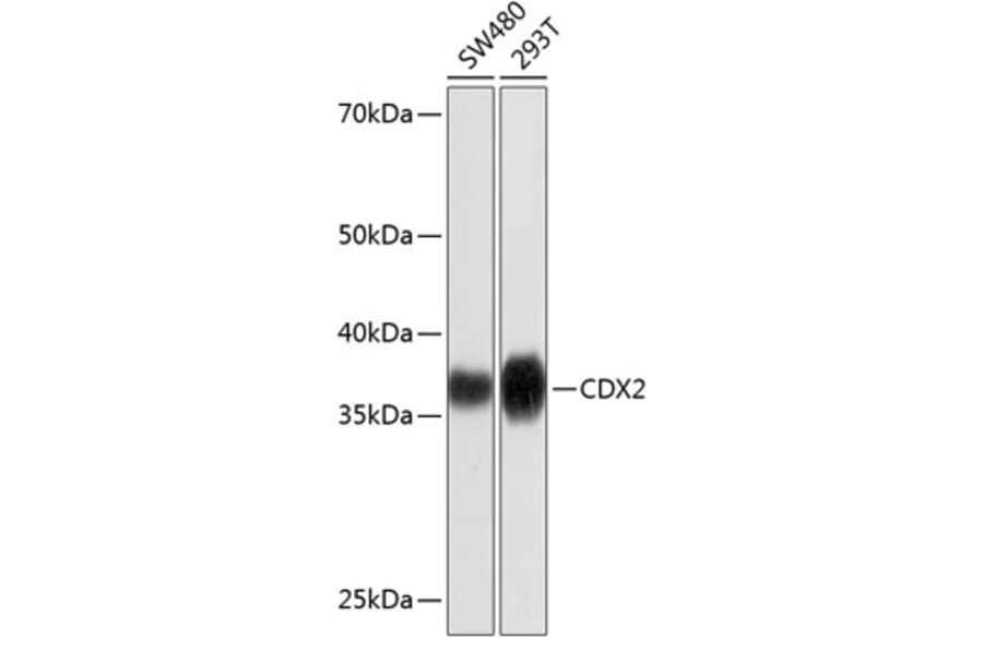 Western Blot - Anti-CDX2 Antibody [ARC0450] (A308015) - Antibodies.com