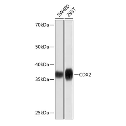 Western Blot - Anti-CDX2 Antibody [ARC0450] (A308015) - Antibodies.com
