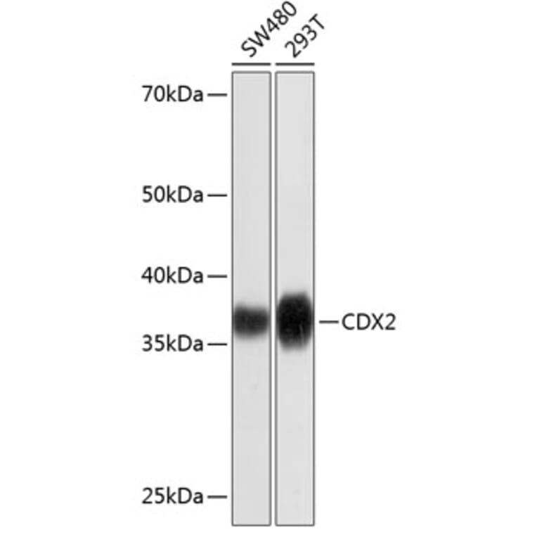 Western Blot - Anti-CDX2 Antibody [ARC0450] (A308015) - Antibodies.com