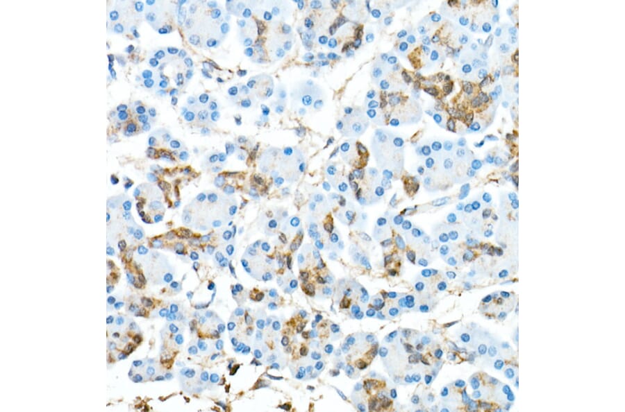 Immunohistochemistry - Anti-CDX2 Antibody [ARC0450] (A308015) - Antibodies.com