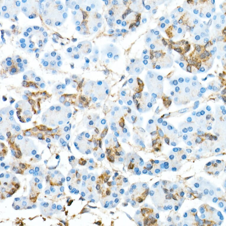 Immunohistochemistry - Anti-CDX2 Antibody [ARC0450] (A308015) - Antibodies.com