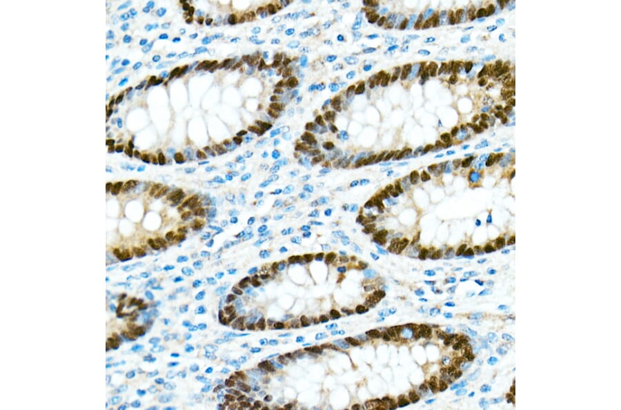 Immunohistochemistry - Anti-CDX2 Antibody [ARC0450] (A308015) - Antibodies.com