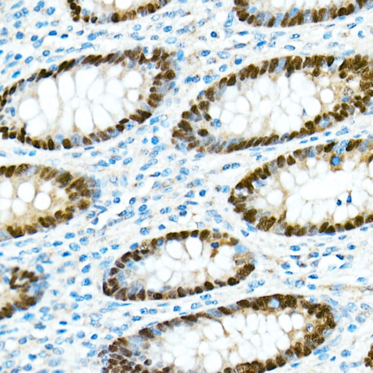 Immunohistochemistry - Anti-CDX2 Antibody [ARC0450] (A308015) - Antibodies.com
