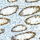 Immunohistochemistry - Anti-CDX2 Antibody [ARC0450] (A308015) - Antibodies.com