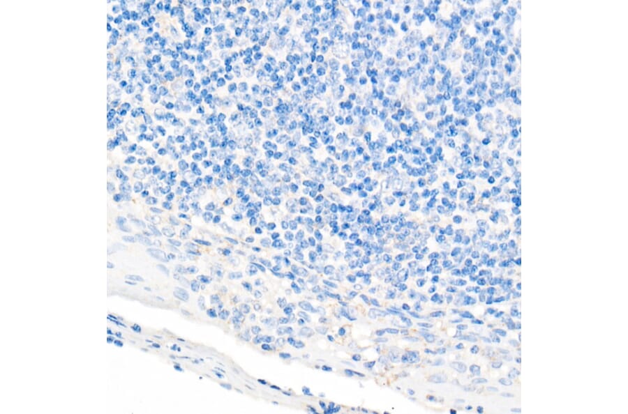 Immunohistochemistry - Anti-CDX2 Antibody [ARC0450] (A308015) - Antibodies.com