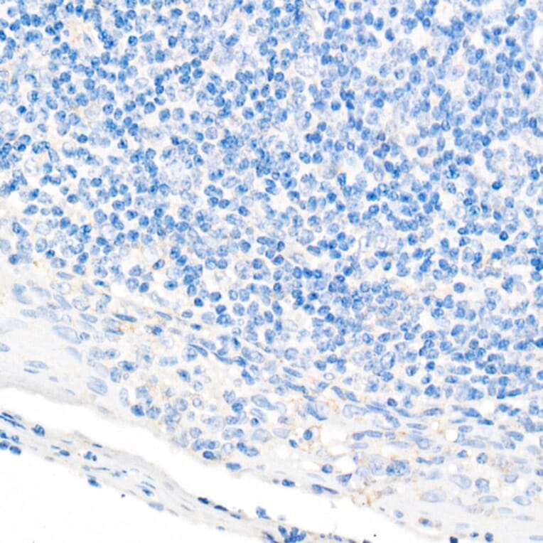 Immunohistochemistry - Anti-CDX2 Antibody [ARC0450] (A308015) - Antibodies.com