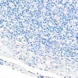 Immunohistochemistry - Anti-CDX2 Antibody [ARC0450] (A308015) - Antibodies.com