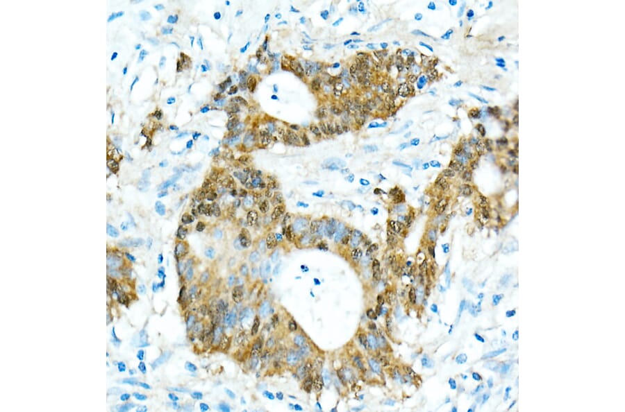 Immunohistochemistry - Anti-CDX2 Antibody [ARC0450] (A308015) - Antibodies.com