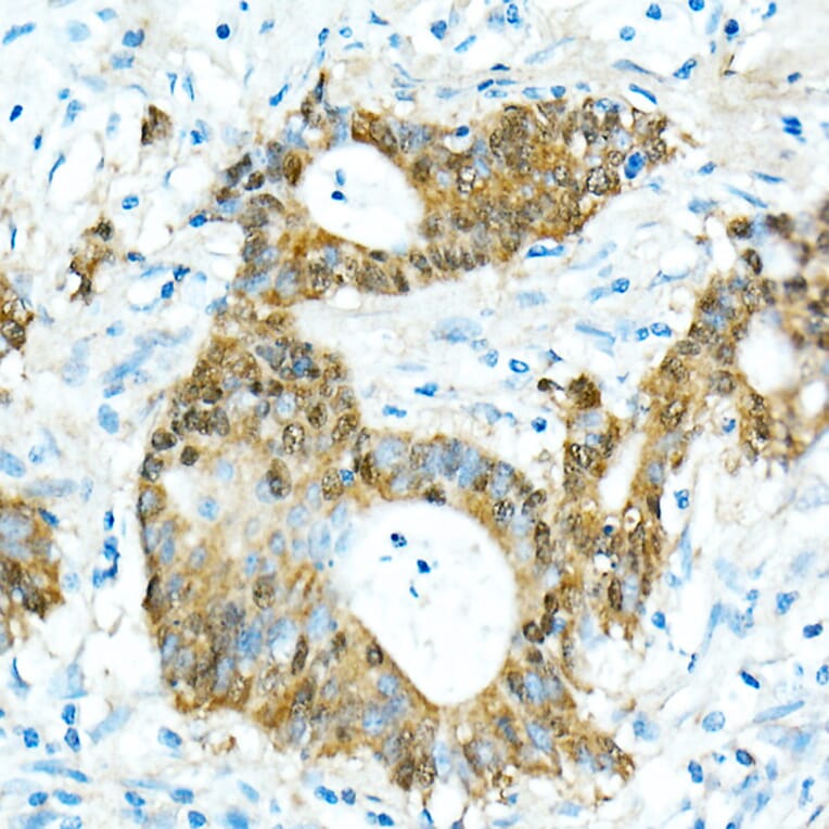 Immunohistochemistry - Anti-CDX2 Antibody [ARC0450] (A308015) - Antibodies.com