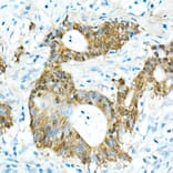 Immunohistochemistry - Anti-CDX2 Antibody [ARC0450] (A308015) - Antibodies.com