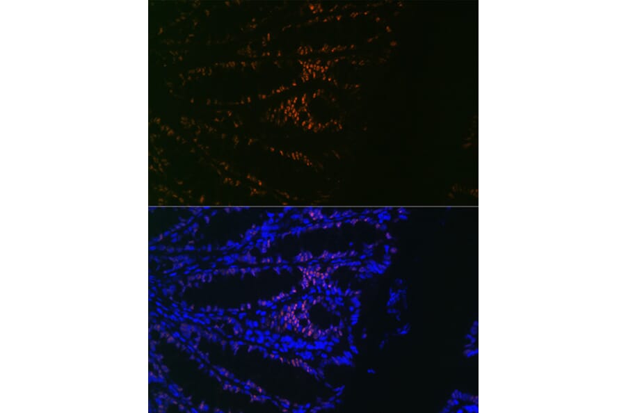 Immunofluorescence - Anti-CDX2 Antibody [ARC0450] (A308015) - Antibodies.com