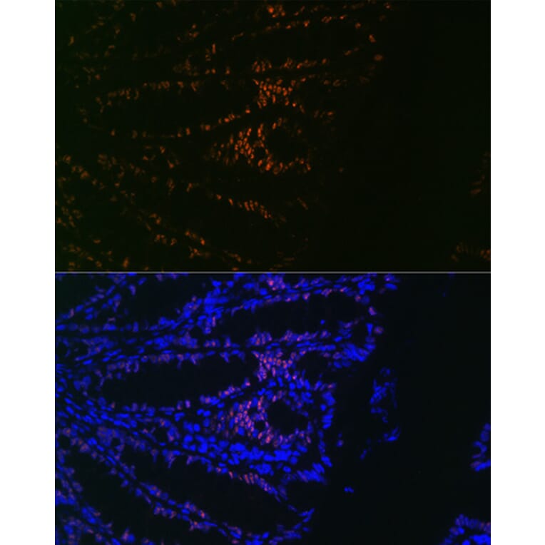 Immunofluorescence - Anti-CDX2 Antibody [ARC0450] (A308015) - Antibodies.com