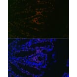 Immunofluorescence - Anti-CDX2 Antibody [ARC0450] (A308015) - Antibodies.com