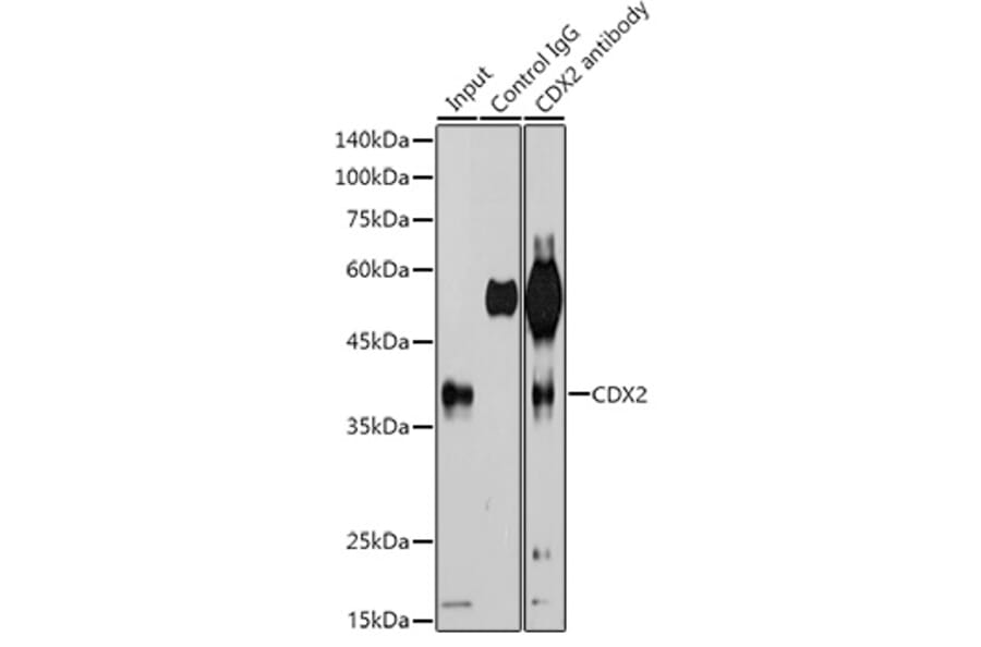 Western Blot - Anti-CDX2 Antibody [ARC0450] (A308015) - Antibodies.com