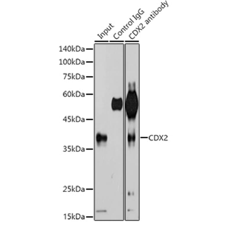 Western Blot - Anti-CDX2 Antibody [ARC0450] (A308015) - Antibodies.com