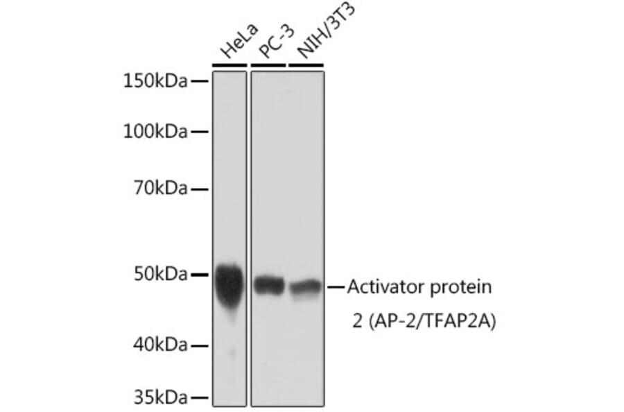 Western Blot - Anti-Transcription factor AP-2-alpha Antibody [ARC1905] (A308016) - Antibodies.com