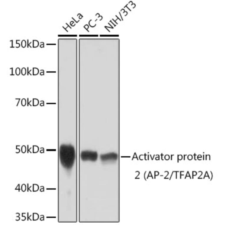 Western Blot - Anti-Transcription factor AP-2-alpha Antibody [ARC1905] (A308016) - Antibodies.com