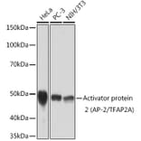 Western Blot - Anti-Transcription factor AP-2-alpha Antibody [ARC1905] (A308016) - Antibodies.com