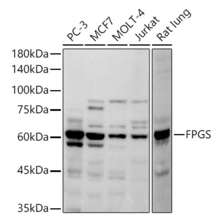 Western Blot - Anti-FPGS Antibody [ARC2964] (A308017) - Antibodies.com