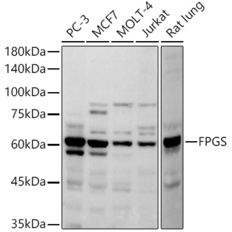 Western Blot - Anti-FPGS Antibody [ARC2964] (A308017) - Antibodies.com