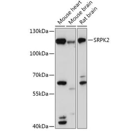 Western Blot - Anti-SRPK2 Antibody (A308018) - Antibodies.com
