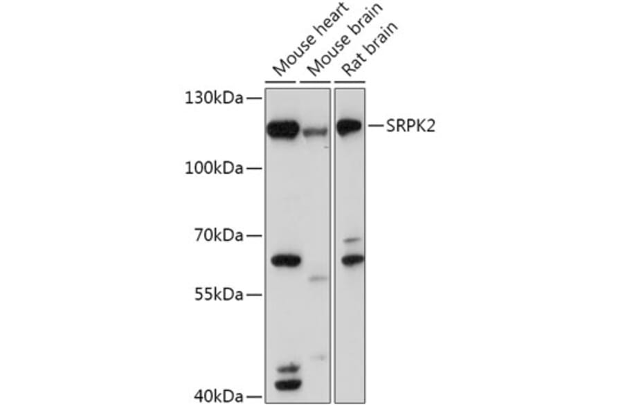 Western Blot - Anti-SRPK2 Antibody (A308018) - Antibodies.com