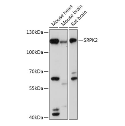 Western Blot - Anti-SRPK2 Antibody (A308018) - Antibodies.com