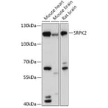 Western Blot - Anti-SRPK2 Antibody (A308018) - Antibodies.com