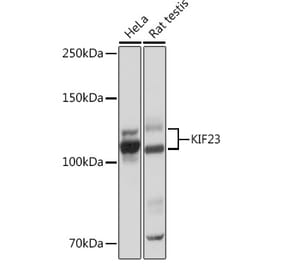 Western Blot - Anti-MKLP1 Antibody [ARC0335] (A308020) - Antibodies.com