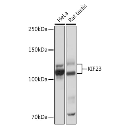 Western Blot - Anti-MKLP1 Antibody [ARC0335] (A308020) - Antibodies.com