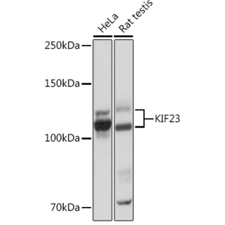 Western Blot - Anti-MKLP1 Antibody [ARC0335] (A308020) - Antibodies.com