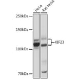 Western Blot - Anti-MKLP1 Antibody [ARC0335] (A308020) - Antibodies.com