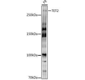 Western Blot - Anti-Tet2 Antibody (A308022) - Antibodies.com