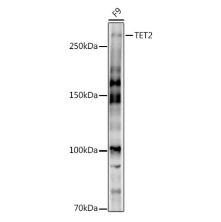 Western Blot - Anti-Tet2 Antibody (A308022) - Antibodies.com