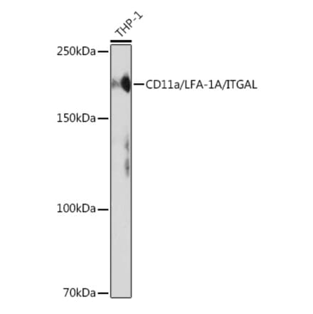 Western Blot - Anti-CD11a Antibody [ARC0344] (A308023) - Antibodies.com