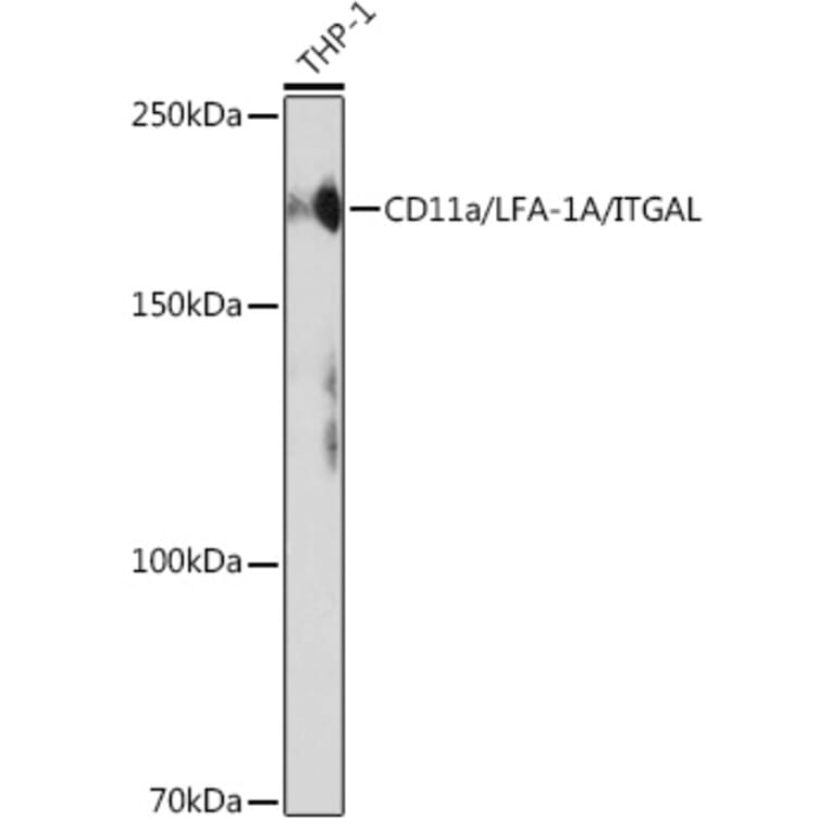 Western Blot - Anti-CD11a Antibody [ARC0344] (A308023) - Antibodies.com