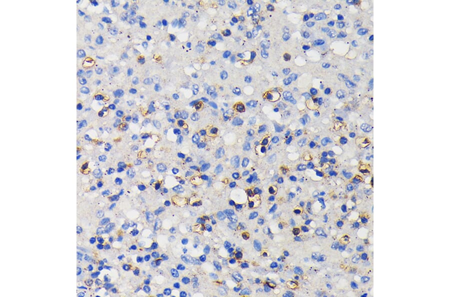 Immunohistochemistry - Anti-CD11a Antibody [ARC0344] (A308023) - Antibodies.com