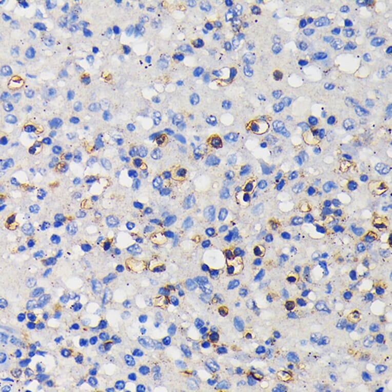 Immunohistochemistry - Anti-CD11a Antibody [ARC0344] (A308023) - Antibodies.com