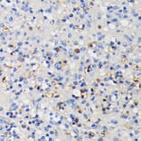 Immunohistochemistry - Anti-CD11a Antibody [ARC0344] (A308023) - Antibodies.com
