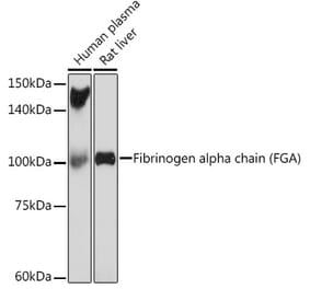 Western Blot - Anti-Fibrinogen Alpha Chain Antibody [ARC2227] (A308025) - Antibodies.com